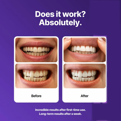LumiStrips™ Purple Whitening Strips